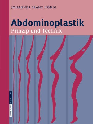 cover image of Abdominoplastik